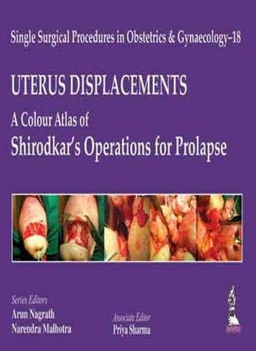 Single Surgical Procedures in Obstetrics and Gynaecology - 18 : UTERUS DISPLACEMENTS