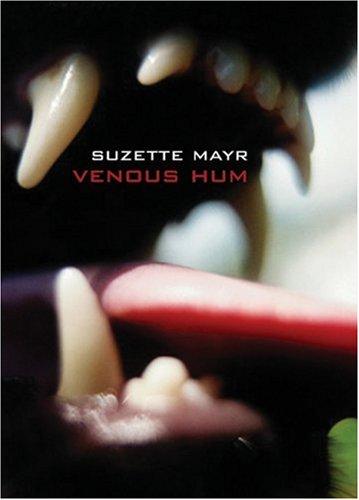 Venous hum