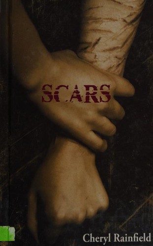 Scars